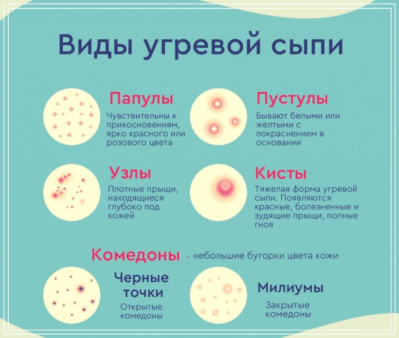 Прыщи После Секса Прыщи После Секса